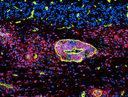 Inflammatory cuff in the cerebellum of a mouse with EAE.