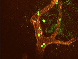 Encephalitogenic T cells (green) interact with inflamed spinal cord micorvessels (red)