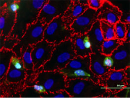 Interaction of human T cells